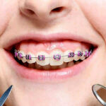 orthodontics